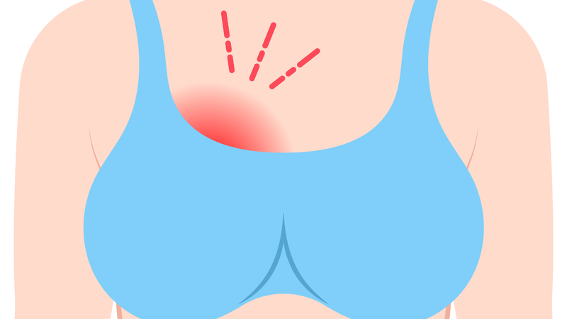 Mẹ bỉm bị tắc tia sữa uống thuốc gì​ để nhanh khỏi?1