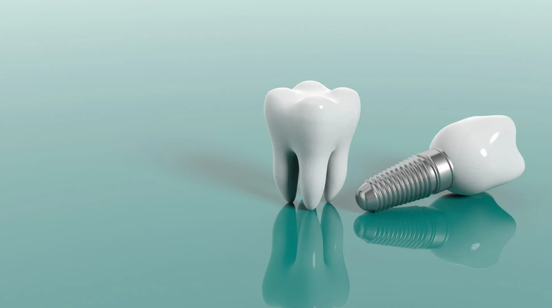 Megagen implant là gì? Có ưu điểm gì so với các loại implant khác? 2