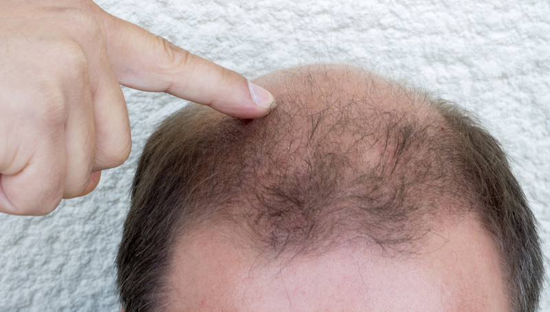 Mẹo chăm sóc tóc nam hiệu quả và cực kỳ đơn giản tại nhà 4