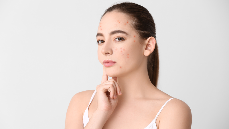 Mẹo giúp tóc không bị bết, nhờn khi tập thể dục 3