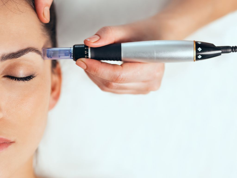 Meso không kim là gì? Ứng dụng của meso không kim trong lĩnh vực làm đẹp 2