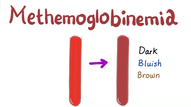 Methemoglobin là gì? Nguyên nhân và cách điều trị bệnh 1