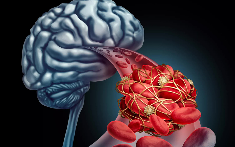 Migrin Plus CVI tăng cường hoạt huyết lên não, cải thiện chứng rối loạn mất ngủ 3