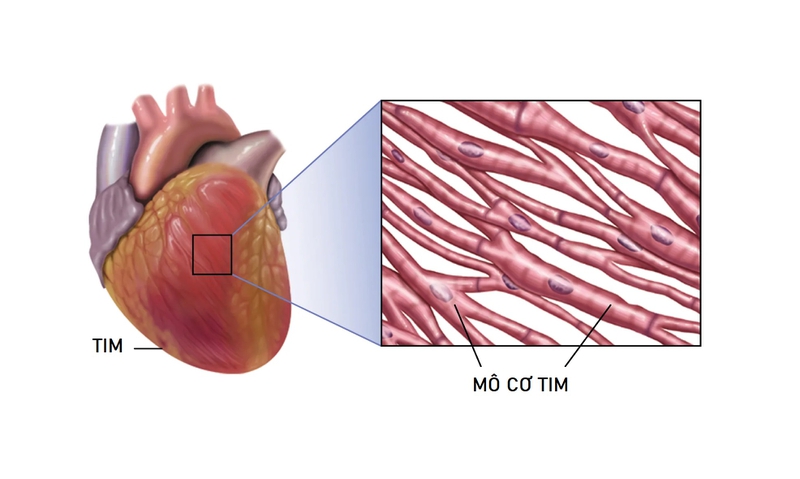 Mô cơ tim là gì? Các bệnh thường gặp ở mô cơ tim 1