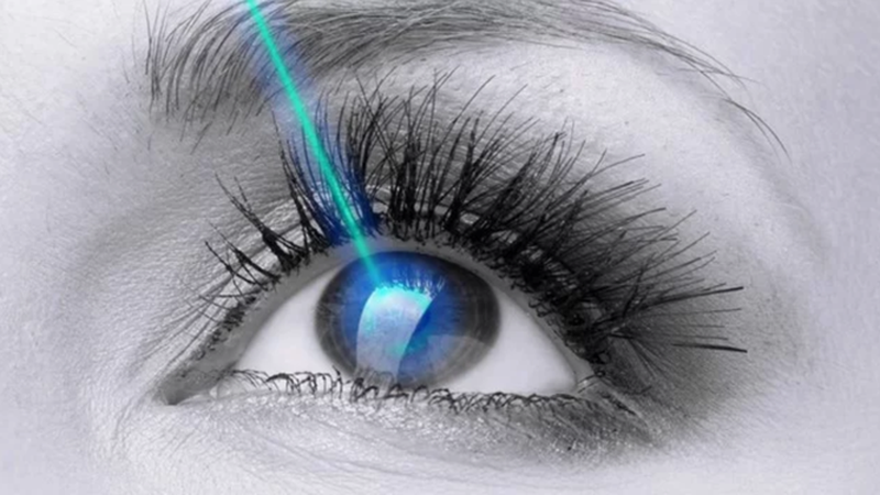 Mổ mắt lasik có bị cận lại không? Những điều cần lưu ý 2