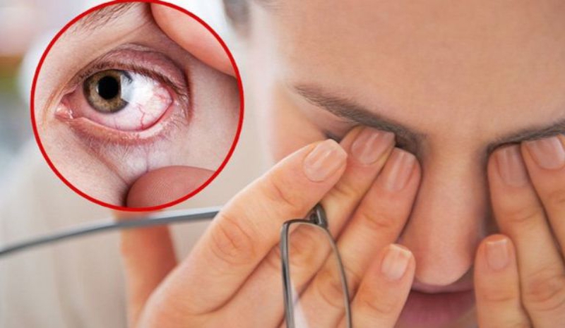 Mổ mắt lasik có bị cận lại không? Những điều cần lưu ý 3