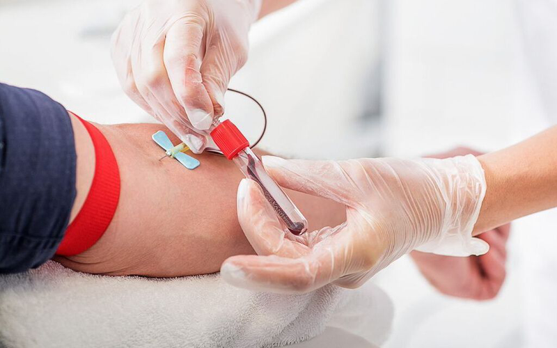 Mỡ máu gia đình: Dấu hiệu nhận biết, phương pháp chẩn đoán và hướng điều trị 3