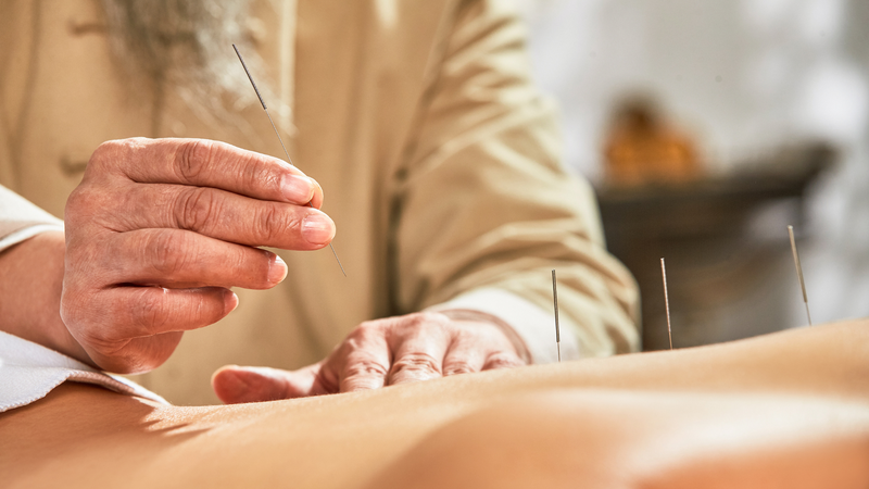 Châm cứu giúp lưu thông khí huyết, tăng chuyển hóa và hỗ trợ giảm mỡ