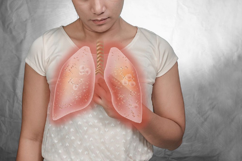 Mủ màng phổi là bệnh gì? Nguyên nhân, cách chẩn đoán và điều trị bệnh 3