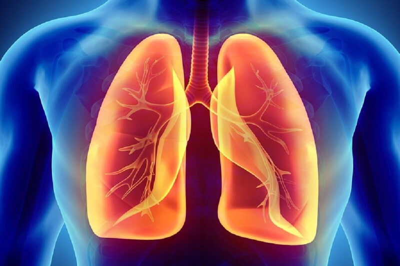 Mủ màng phổi là bệnh gì? Nguyên nhân, cách chẩn đoán và điều trị bệnh 4