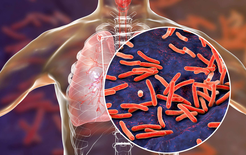 Mycobacterium Tuberculosis và những điều bạn cần biết 1