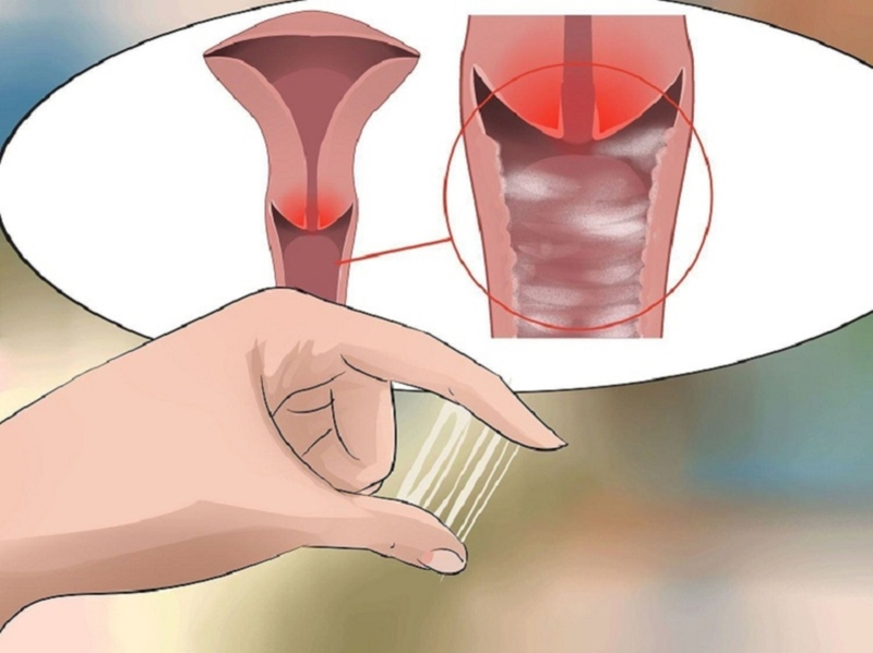 Nấm âm đạo là gì? Cách sử dụng lá húng quế rửa vùng kín điều trị nấm âm đạo ngay tại nhà 2