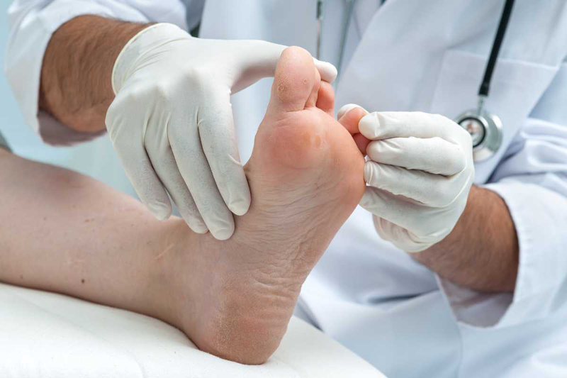 Nấm bàn chân: Nguyên nhân, triệu chứng, cách điều trị 4