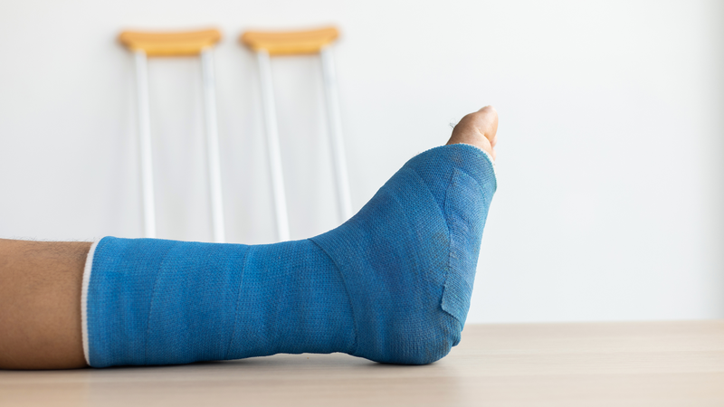  Nẹp bột có tác dụng gì trong điều trị chấn thương? 1