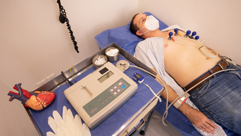 Ngoại tâm thu nhĩ được phân loại dựa trên một số đặc điểm về hình thái, tần suất và kiểu phân bố trên điện tâm đồ