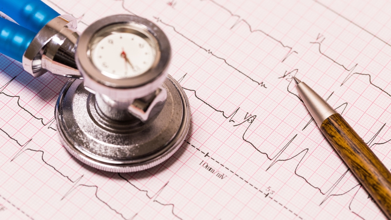 Điện tâm đồ là phương pháp chẩn đoán nền tảng và thường được chỉ định đầu tiên