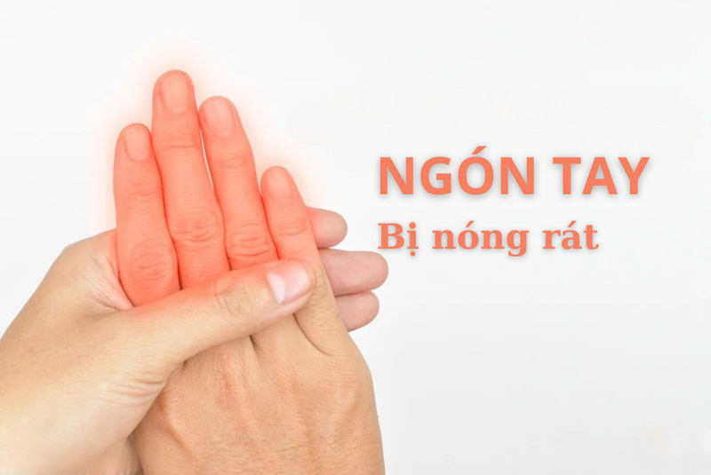 ngon-tay-bi-nong-rat-2.jpg