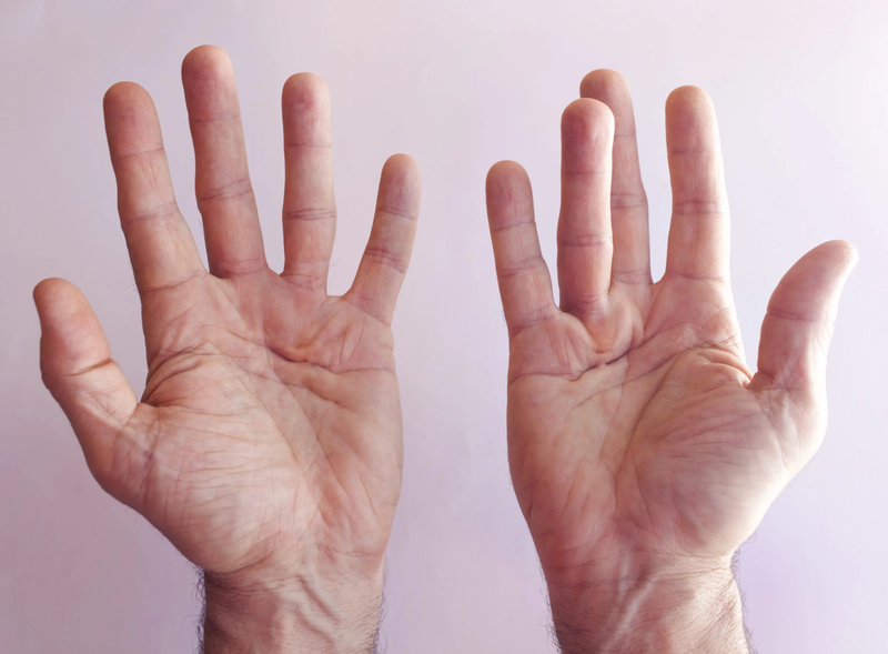 Ngón tay giữa bên trái không bật lên có nguy hiểm không? 3