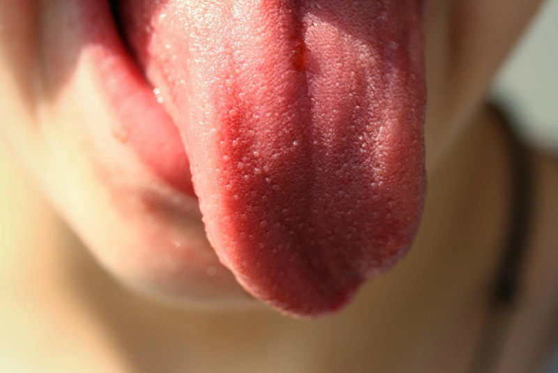 Ngứa lưỡi: Triệu chứng nói lên tình trạng sức khỏe không ổn định của bạn 1