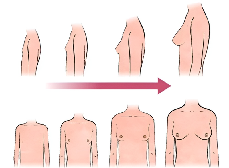 Ngực không phát triển ở tuổi dậy thì là do đâu và có cách nào cải thiện chúng? 1