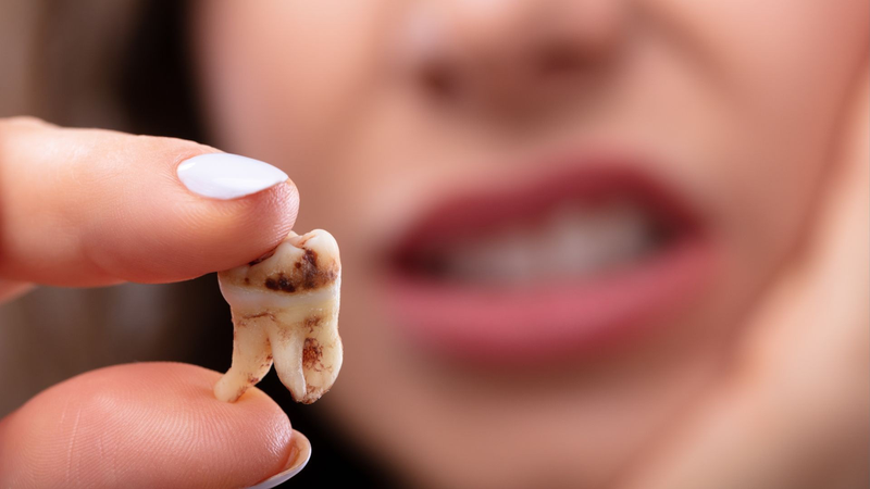 Người có 30 cái răng thì sao? Có thể họ bẩm sinh chỉ có 2 răng khôn