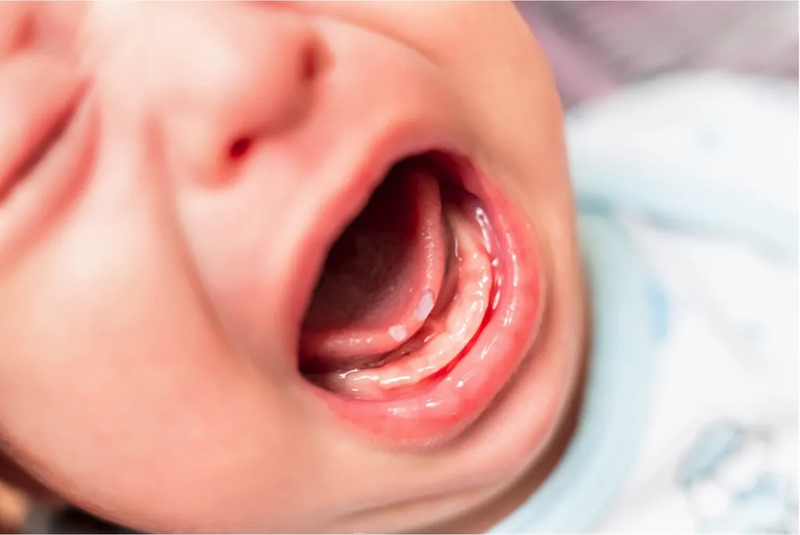 Nguyên nhân và cách điều trị khi bé bị nhiệt miệng hôi miệng 1