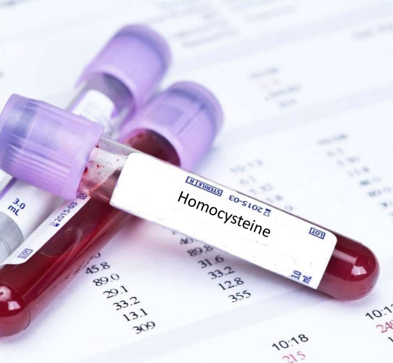 Nguyên nhân vì sao chỉ số Homocysteine cao làm tăng nguy cơ bệnh tim? 1
