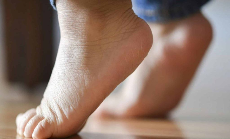 Chấn thương gót chân: Nhận biết dấu hiệu, chẩn đoán sớm và điều trị đúng cách 1