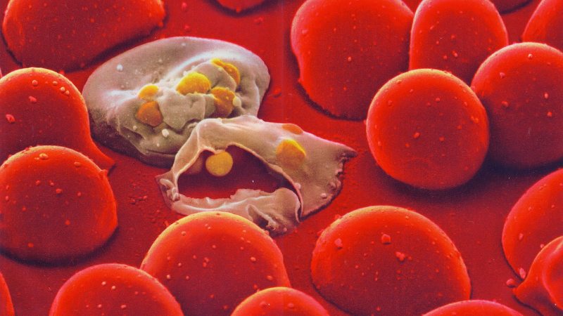 Tan máu bẩm sinh là bệnh di truyền liên quan đến đột biến gen