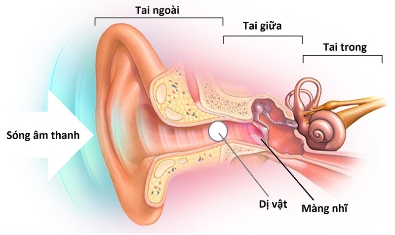 Nhận biết trẻ mắc dị vật tai mũi họng và cách xử trí 1
