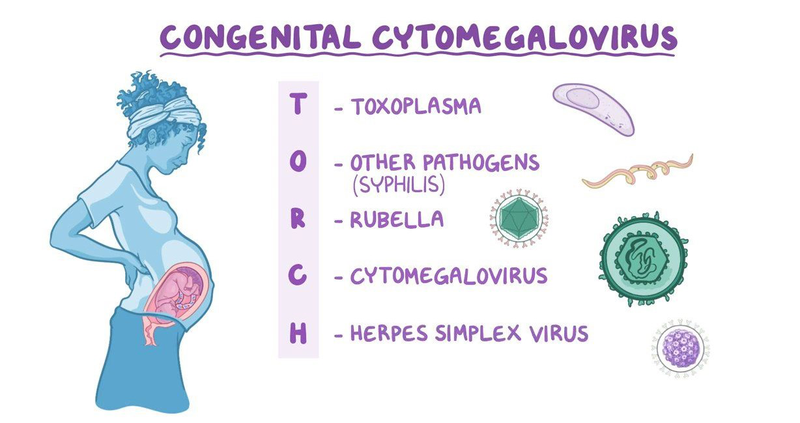 Nhiễm Cytomegalovirus: Nguyên nhân, triệu chứng, phương pháp phòng và điều trị 5
