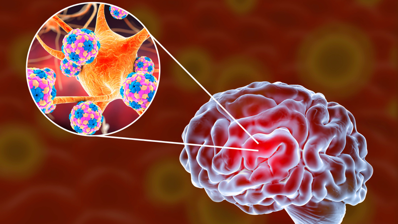 Nhiễm nấm Histoplasma là bệnh gì? Dấu hiệu nhận biết, nguyên nhân và cách phòng ngừa 4