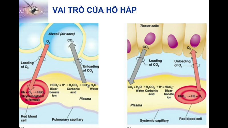 Nhiễm toan hô hấp