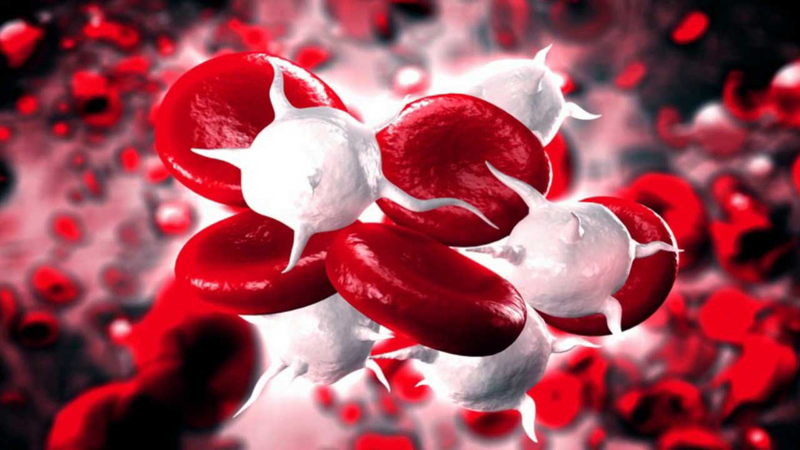 Nhiễm trùng máu kiêng ăn gì để đảm bảo sức khỏe?