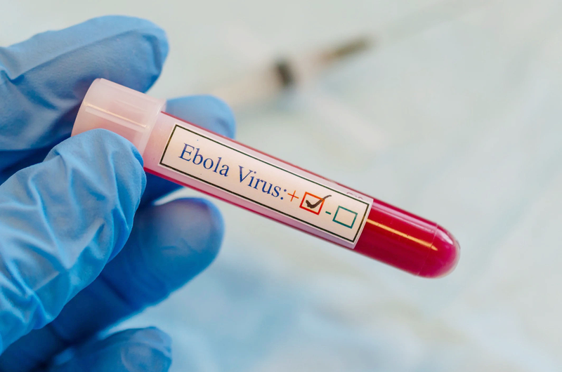 Nhiễm Virus Ebola có biểu hiện gì? Cách điều trị và phòng ngừa - 2