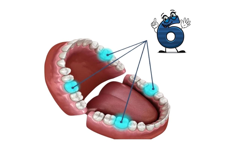 Nhổ răng số 6 bao lâu thì lành? Khi nào cần nhổ răng số 6 1