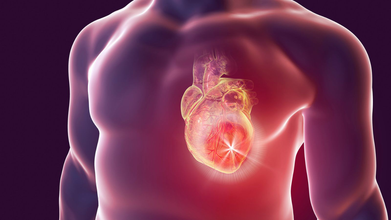 Nhồi máu cơ tim sống được bao lâu? Những điều cần biết để kéo dài tuổi thọ 1