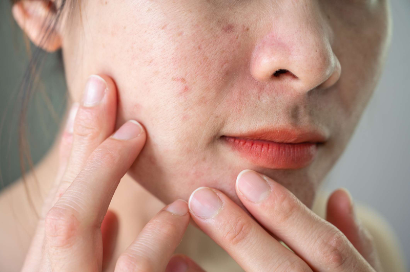 Những cách làm mịn da mặt​ để làn da luôn khỏe mạnh nhất 2