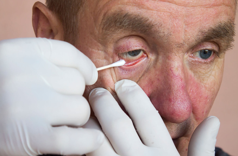 Những dấu hiệu bệnh đau mắt đỏ bạn không nên bỏ qua3
