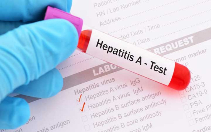 Những điều cần biết về HAV IgM test và căn bệnh truyền nhiễm viêm gan A 2