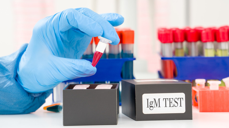 Những điều cần biết về HAV IgM test và căn bệnh truyền nhiễm viêm gan A 3