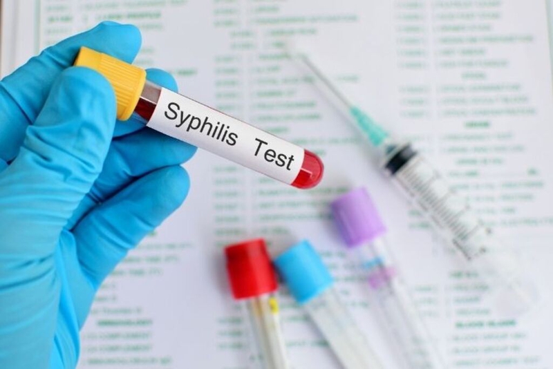 Những điều cần biết về xét nghiệm Syphilis ab và bệnh giang mai 3