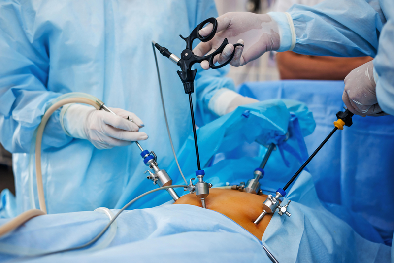Những lưu ý khi phẫu thuật nội soi cắt đại tràng 1