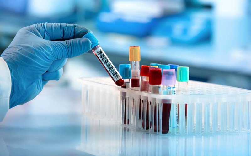 Những thông tin cần biết: Xét nghiệm máu tổng quát biết được những bệnh gì? 1