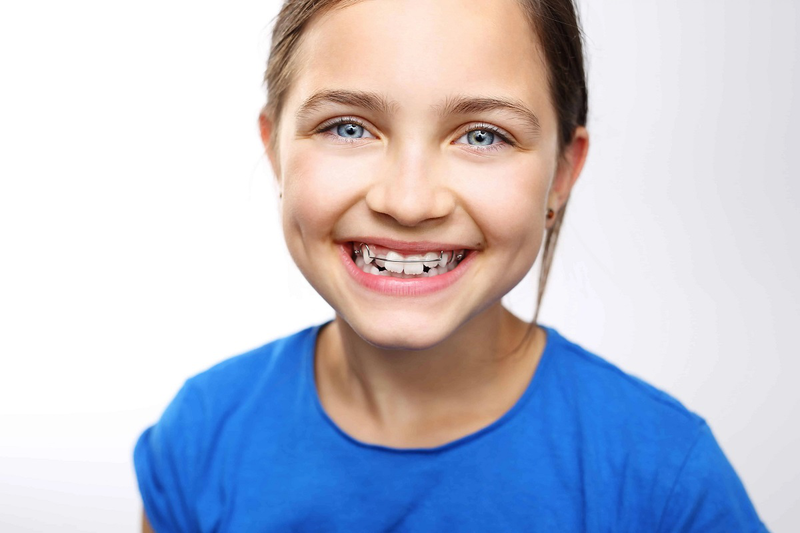 Niềng răng bị lệch mặt: Nguyên nhân, cách khắc phục và cách phòng ngừa 3