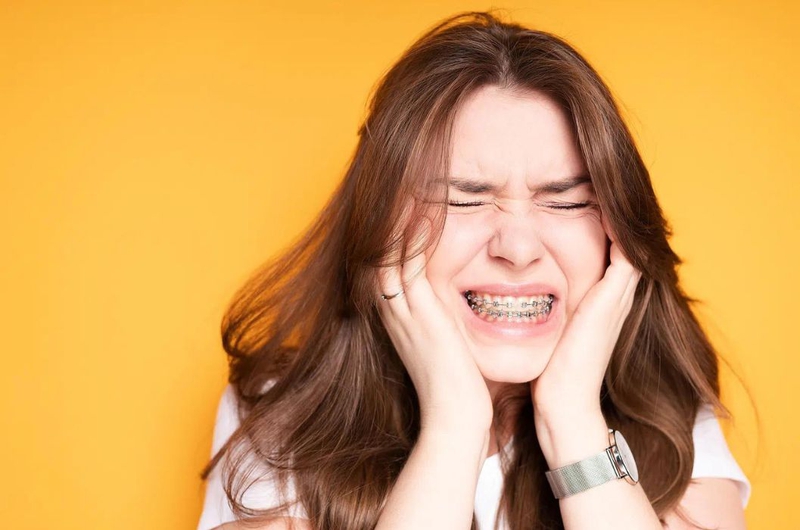 Niềng răng bị nhiệt miệng: Nguyên nhân, cách điều trị và phòng ngừa 2