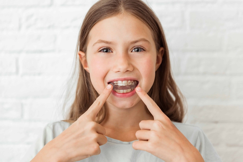Niềng răng trẻ em giá bao nhiêu tiền? Có nên niềng không? 1