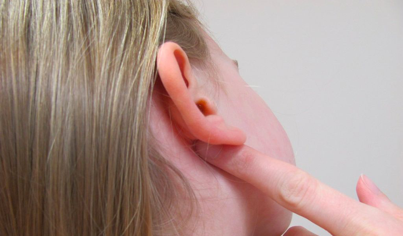 Nổi mụn ở vành tai là do đâu? Cách điều trị hiệu quả 2