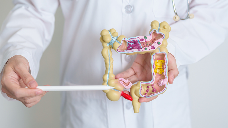 Nội soi đại tràng là một phương pháp quan trọng để tầm soát ung thư đại tràng