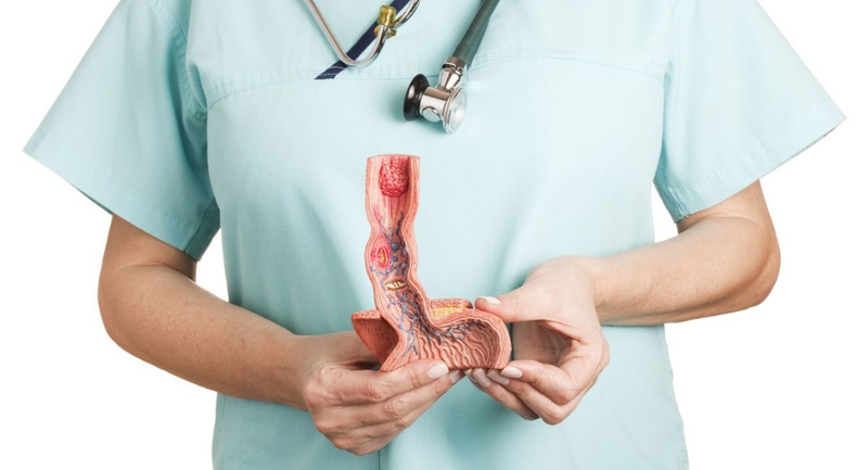 Nóng rát thực quản: Nguyên nhân, biến chứng và cách điều trị 2